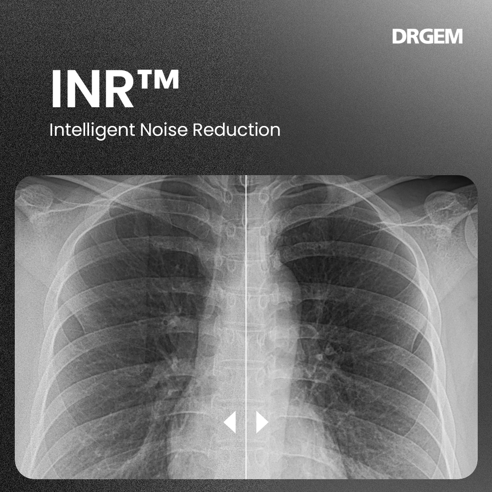 DRGEM INR